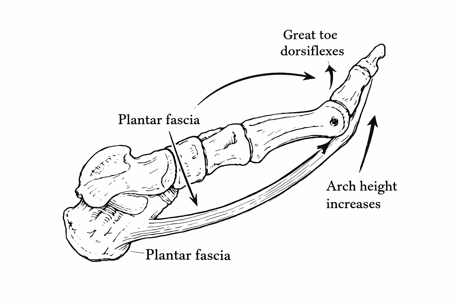 Foot bones and plantar fascia illustrating the windlass: great toe dorsiflexion tightens the fascia and raises the arch.